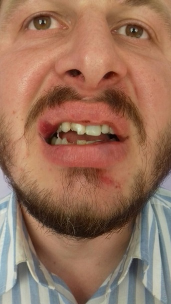 Массовая драка в вотчине Порошенко