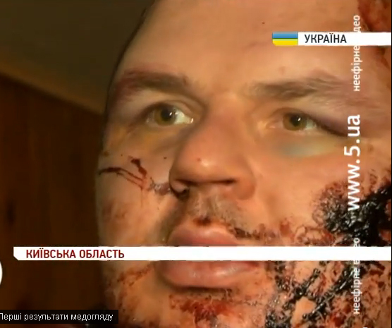 Очередной фэйк от европидорасов - Нашелся Дмитрий Булатов. Его пытали российские садисты Очередной фэйк от европидорасов - Нашелся Дмитрий Булатов. Его пытали российские садисты