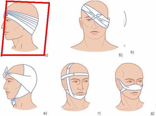 О «глазках на асфальте» и не только...