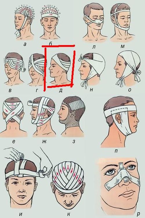 О «глазках на асфальте» и не только...