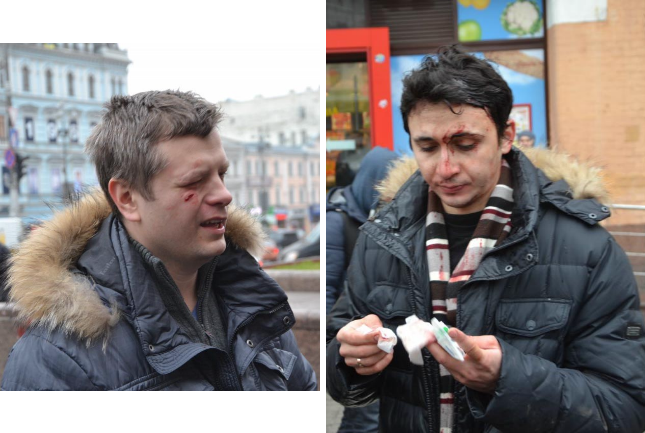 Нацисты с «евромайдана» зверски избили киевлян, вышедших на субботник Нацисты с «евромайдана» зверски избили киевлян, вышедших на субботник