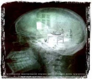 Вести из Дурдома