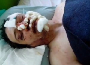 Выживший из Дома Профсоюзов в Одессе - Я выбросился из окна (видео)