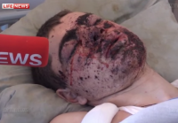 Раненый боец ВСУ признался, что его заставляли воевать