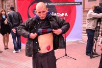 Киевская полиция задержала человека с вываливающимися кишками, пришедшего просить у Кличко деньги на операцию