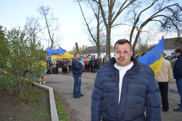 В Запорожье до полусмерти избили соратника Ляшко В Запорожье до полусмерти избили соратника Ляшко