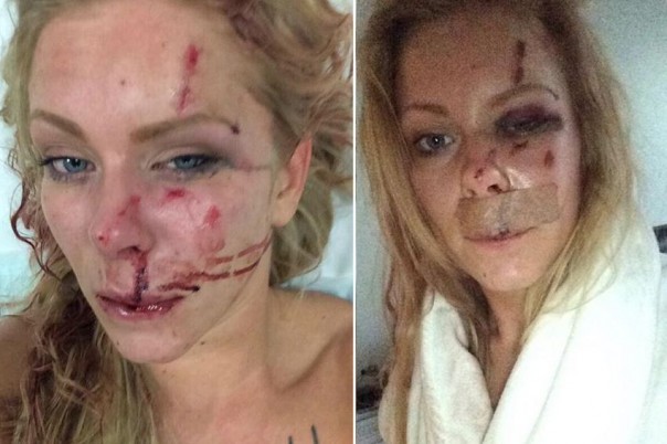 Датчанка заплатит штраф за то, что помешала беженцу себя изнасиловать