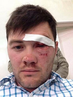 СМИ: в Одессе обстреляли журналистов. Полиция задержала стрелявших (Видео) СМИ: в Одессе обстреляли журналистов. Полиция задержала стрелявших (Видео)