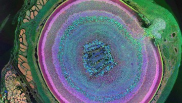 Японские ученые впервые вернули зрение при помощи стволовых клеток