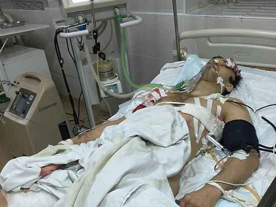 В чемпиона по тайскому боксу всадили шесть пуль. Стала известна причина расстрела бойца MMA Шамхалаева: «Стреляй, если мужчина»