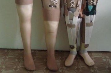 Единая нация: бизнесмены-патриоты украли пластиковые ноги и руки у инвалидов АТО