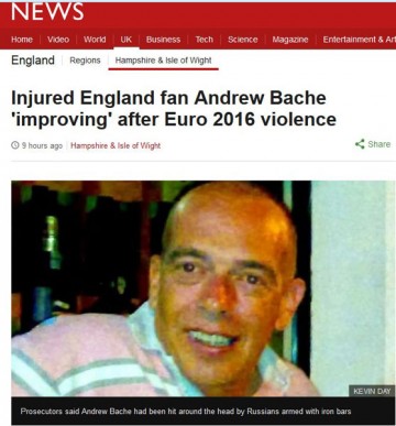 Английский фанат вышел из комы после полученной в ходе беспорядков в Марселе травмы мозга