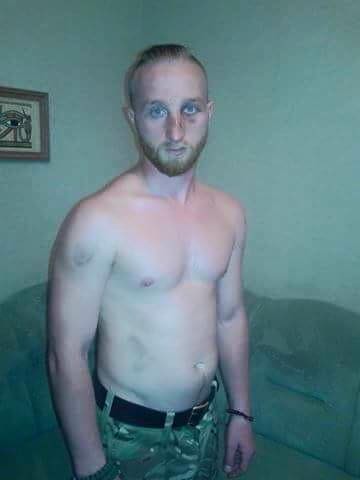 В Киеве жестоко избили боевика «Правого сектора», воевавшего в Донбассе 