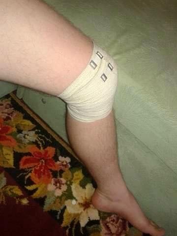 В Киеве жестоко избили боевика «Правого сектора», воевавшего в Донбассе 