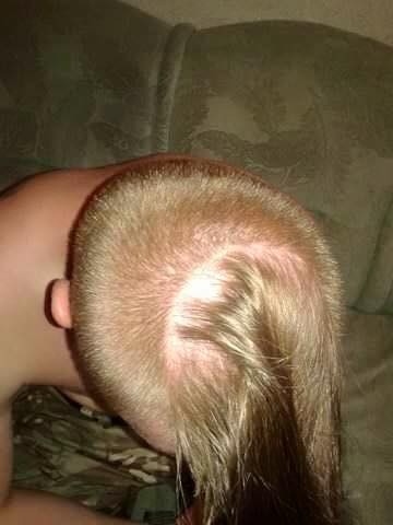 В Киеве жестоко избили боевика «Правого сектора», воевавшего в Донбассе 