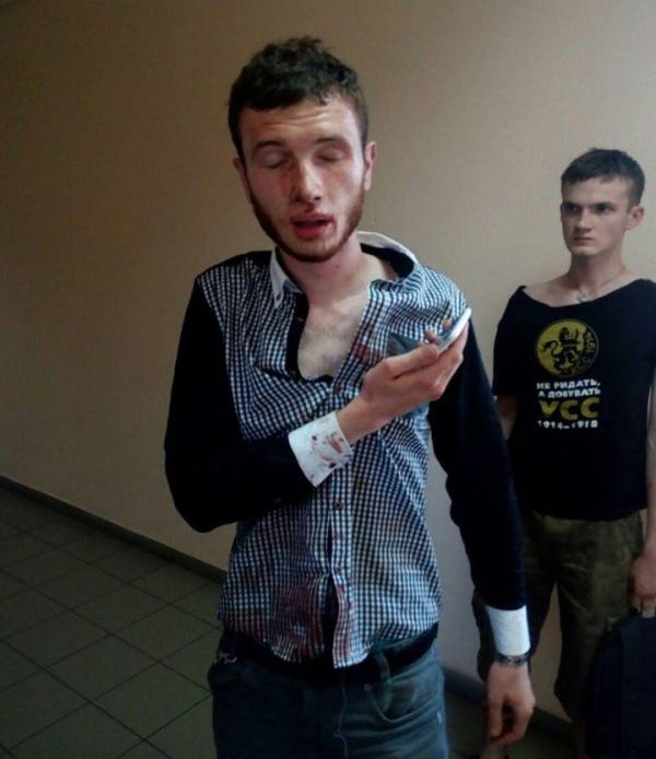 Появилось видео, как принудительно отбирали биообразцы у подозреваемых в убийстве Бузины