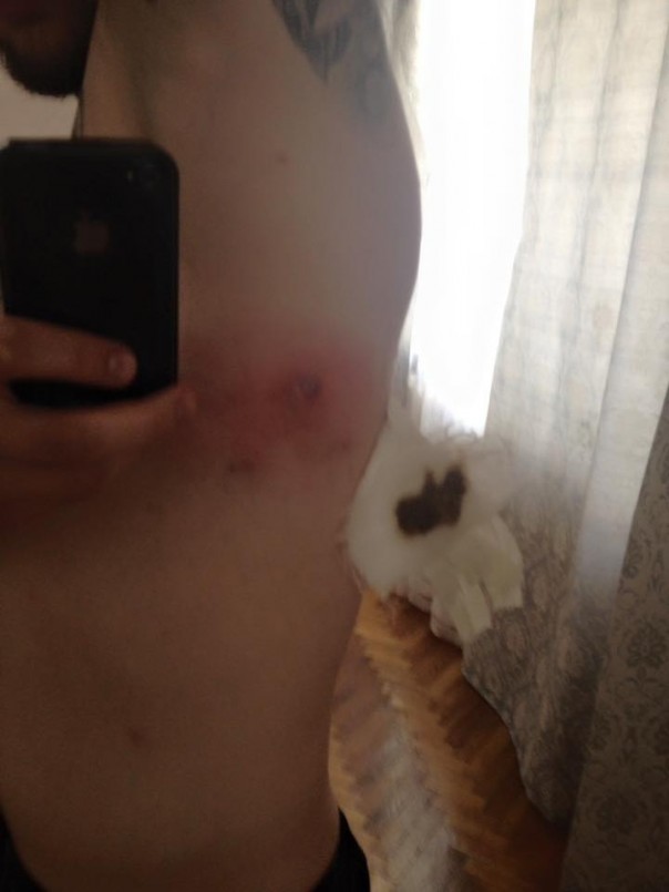 Фурункул имени Путина Фурункул имени Путина