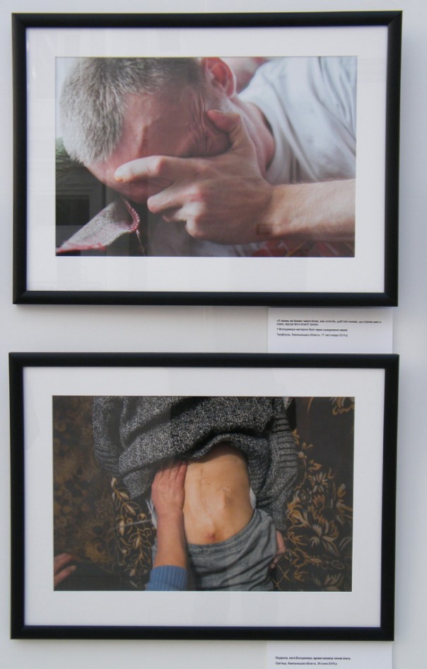 «Я назвал свой нерв Путиным – он меня мучает постоянно» – в Киеве открылась выставка фото искалеченных солдат АТО «Я назвал свой нерв Путиным – он меня мучает постоянно» – в Киеве открылась выставка фото искалеченных солдат АТО