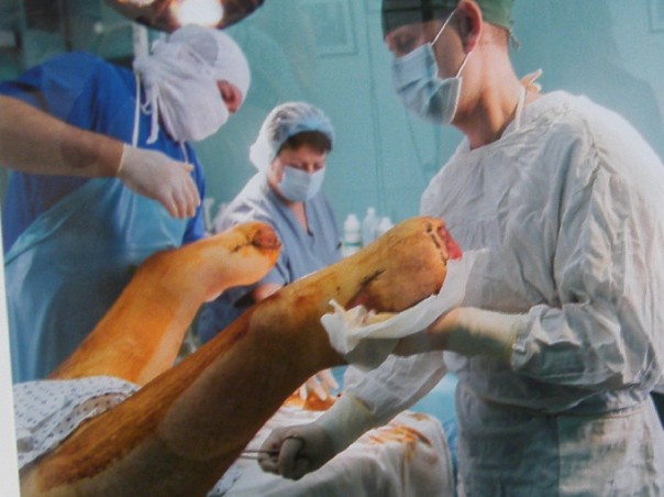 «Я назвал свой нерв Путиным – он меня мучает постоянно» – в Киеве открылась выставка фото искалеченных солдат АТО «Я назвал свой нерв Путиным – он меня мучает постоянно» – в Киеве открылась выставка фото искалеченных солдат АТО