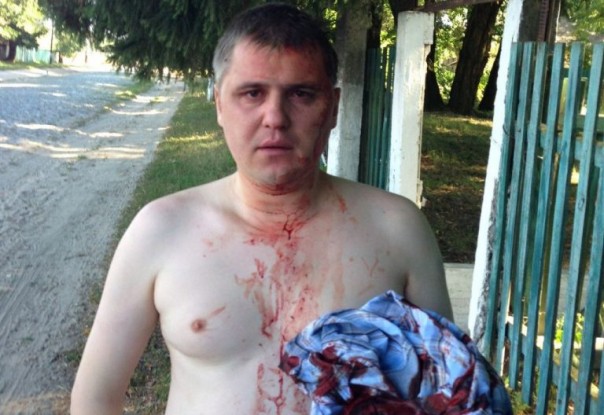 В Чернигове Азов избил коммуниста Кононовича