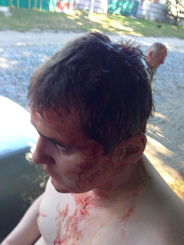 В Чернигове Азов избил коммуниста Кононовича