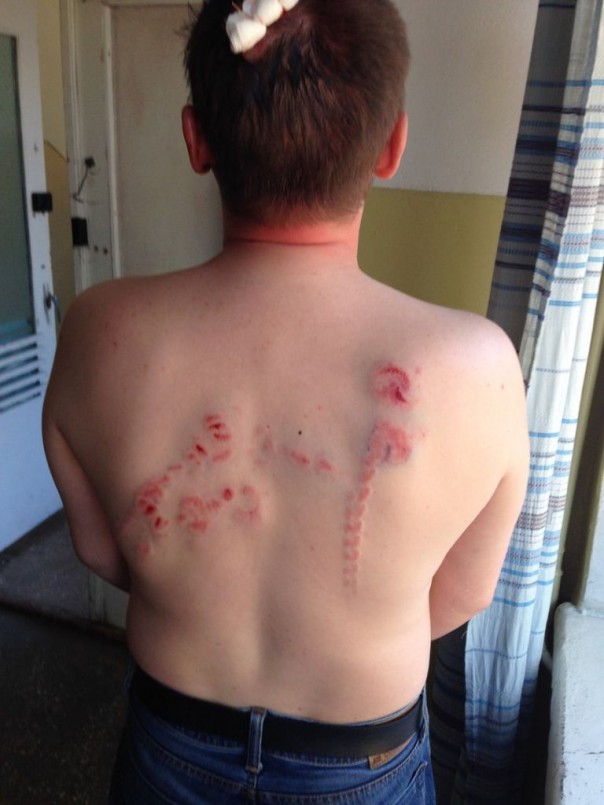 В Чернигове Азов избил коммуниста Кононовича