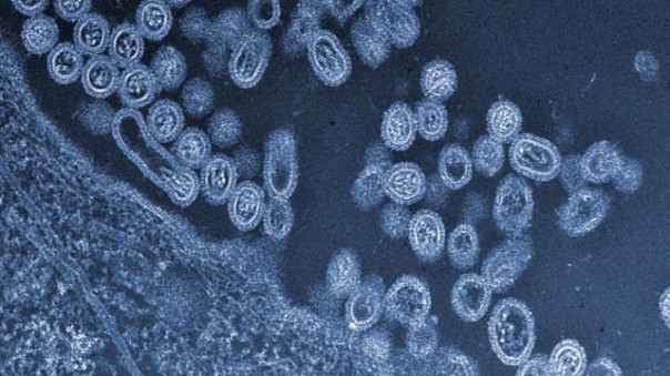 Россия и Канада: губительное влияние птичьего гриппа на отношения стран