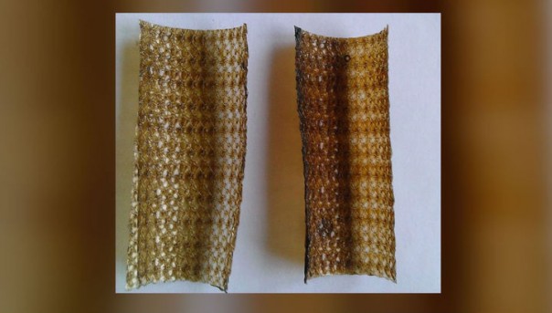 Российские физики разработали методику, помогающую имплантатам безопасно прижиться в организме человека