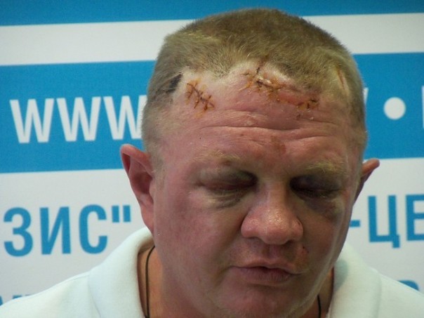 Позорный финиш майдана, или Дохлая лошадь запорожской «Самообороны»