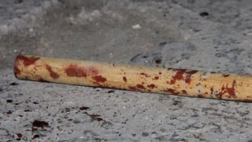 Новости Тернопiля . «Атошника» забили палкой как собаку