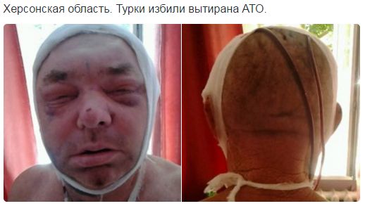 Потерь НЕТ - терять некого! Потери укрофашистов с 1 по 31 августа (Фото) Потерь НЕТ - терять некого! Потери укрофашистов с 1 по 31 августа (Фото)