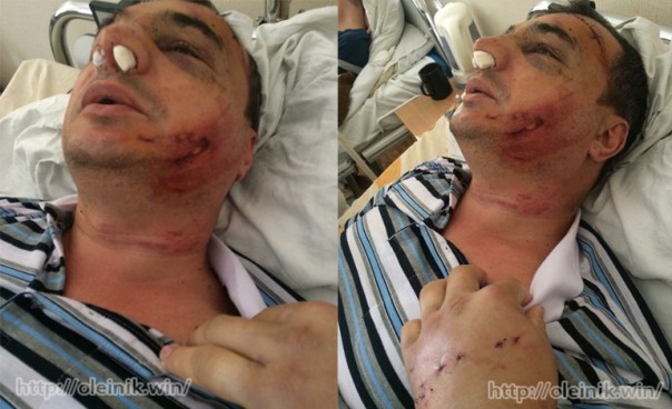 Арсен Клинчаев: я был в списке смертников Порошенко, но чудом выжил. Мы должны освободить из украинских тюрем тысячи несогласных с режимом