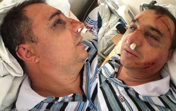 Арсен Клинчаев: я был в списке смертников Порошенко, но чудом выжил. Мы должны освободить из украинских тюрем тысячи несогласных с режимом