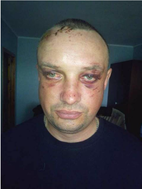 Пьяных в дым начальников СБУ и ВСУ избили и задержали добробатовцы под Мариуполем 