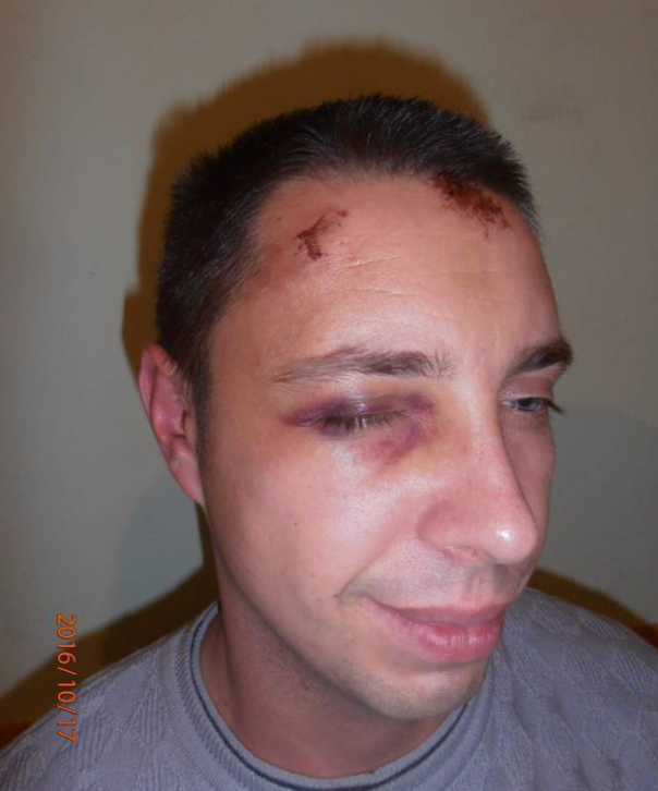 Пьяных в дым начальников СБУ и ВСУ избили и задержали добробатовцы под Мариуполем 