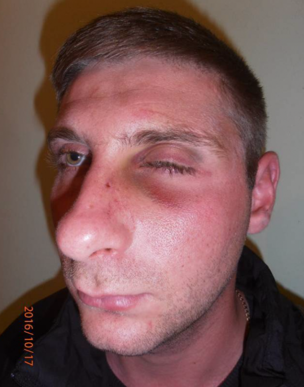 Пьяных в дым начальников СБУ и ВСУ избили и задержали добробатовцы под Мариуполем 