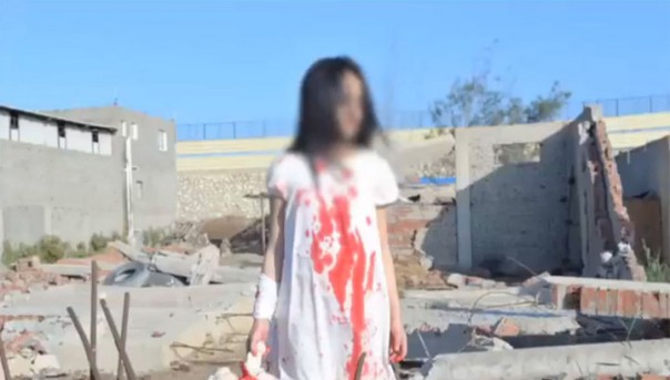 В Египте задержали фотографа за постановку съемки "раненых детей из Алеппо"