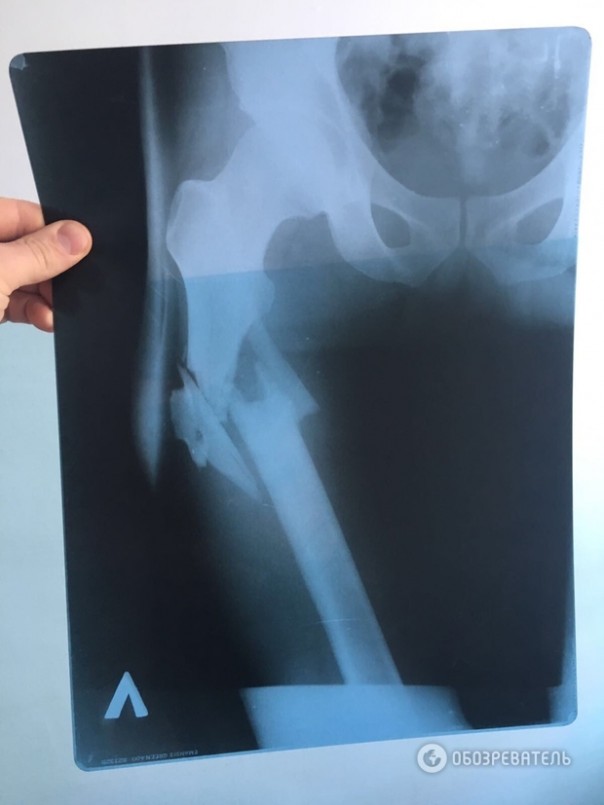 Врач подтвердил, что Пашинский соврал в своих показаниях Врач подтвердил, что Пашинский соврал в своих показаниях