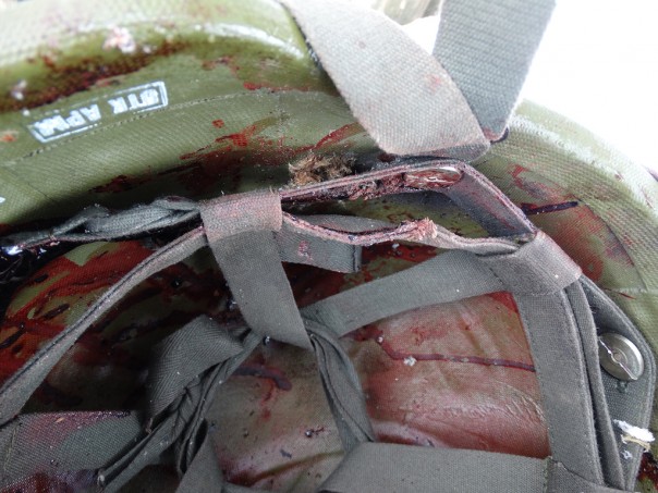 Новый российский шлем спас ополченца ДНР Новый российский шлем спас ополченца ДНР