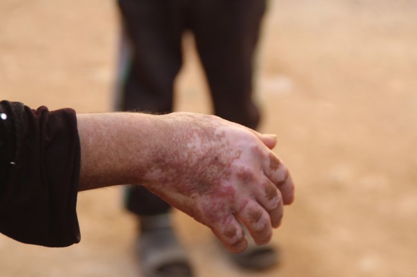 Новый химический элемент в ближневосточном противостоянии – «Иорданий» | Обзор карты боевых действий в Сирии и Ираке от 21.01.2017г