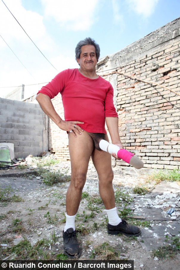 В Мексике обладателя 45-сантиметрового полового органа признали инвалидом (18+)