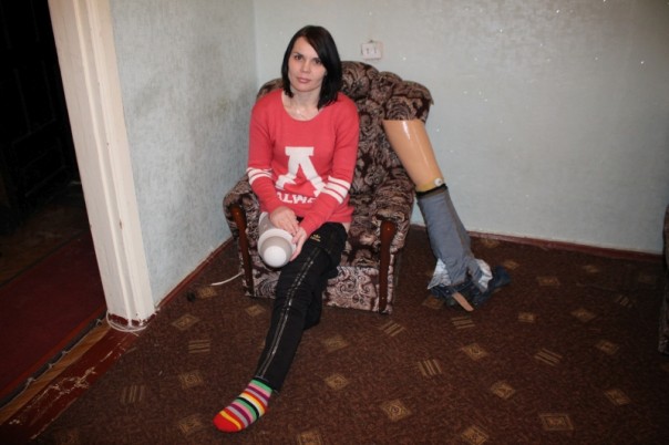 Ополченка Вера: без ноги, жилья и средств к существованию