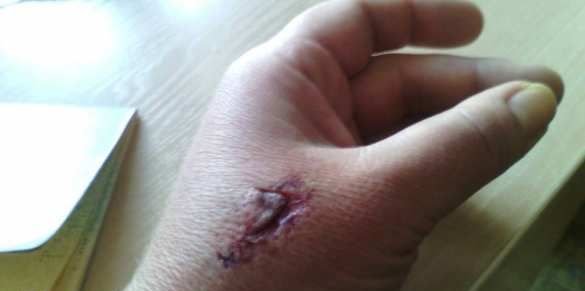 Продавец, избившая вдову карателя, рассказала подробности драки: "Назвала меня курвой и вцепилась ногтями в лицо" 