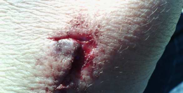 Продавец, избившая вдову карателя, рассказала подробности драки: "Назвала меня курвой и вцепилась ногтями в лицо" 