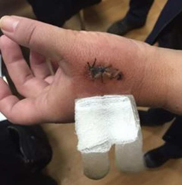 Продавец, избившая вдову карателя, рассказала подробности драки: "Назвала меня курвой и вцепилась ногтями в лицо" 