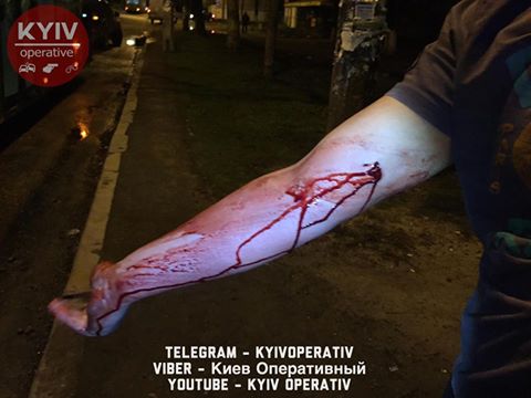 В Киеве устроили кровавую поножовщину в троллейбусе