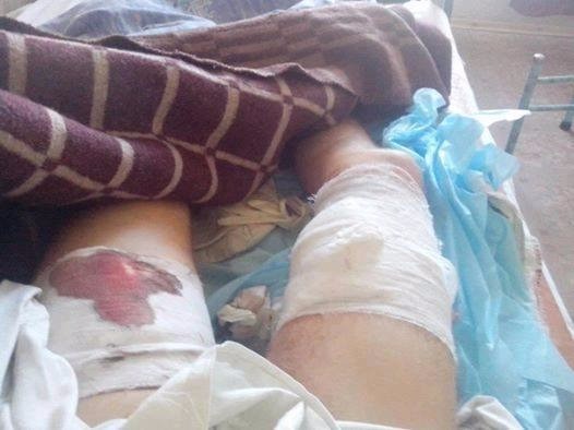 "Сафари на сепаров": бандеровцы приветствуют покушение на жизнь левого активиста и анонсируют новые расправы с неугодными 