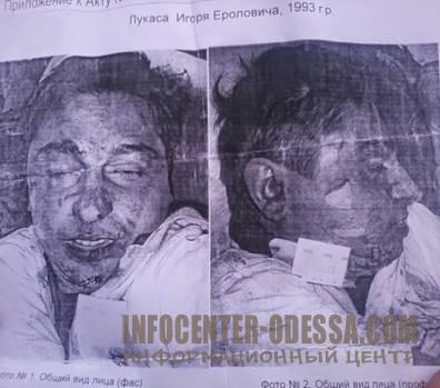 Три года Одесской Хатыни (18+)