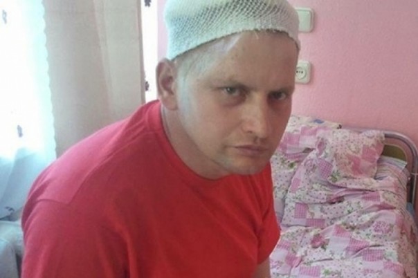 Отъявленные психи: в Украине насчитали 70 тысяч АТОшников, раненных на всю голову