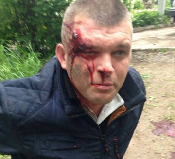 Пробитое днище театра абсурда: на таксиста открыли уголовное дело за нападение на охранника Яроша